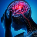 15+ Awareness Strokes Slogan List